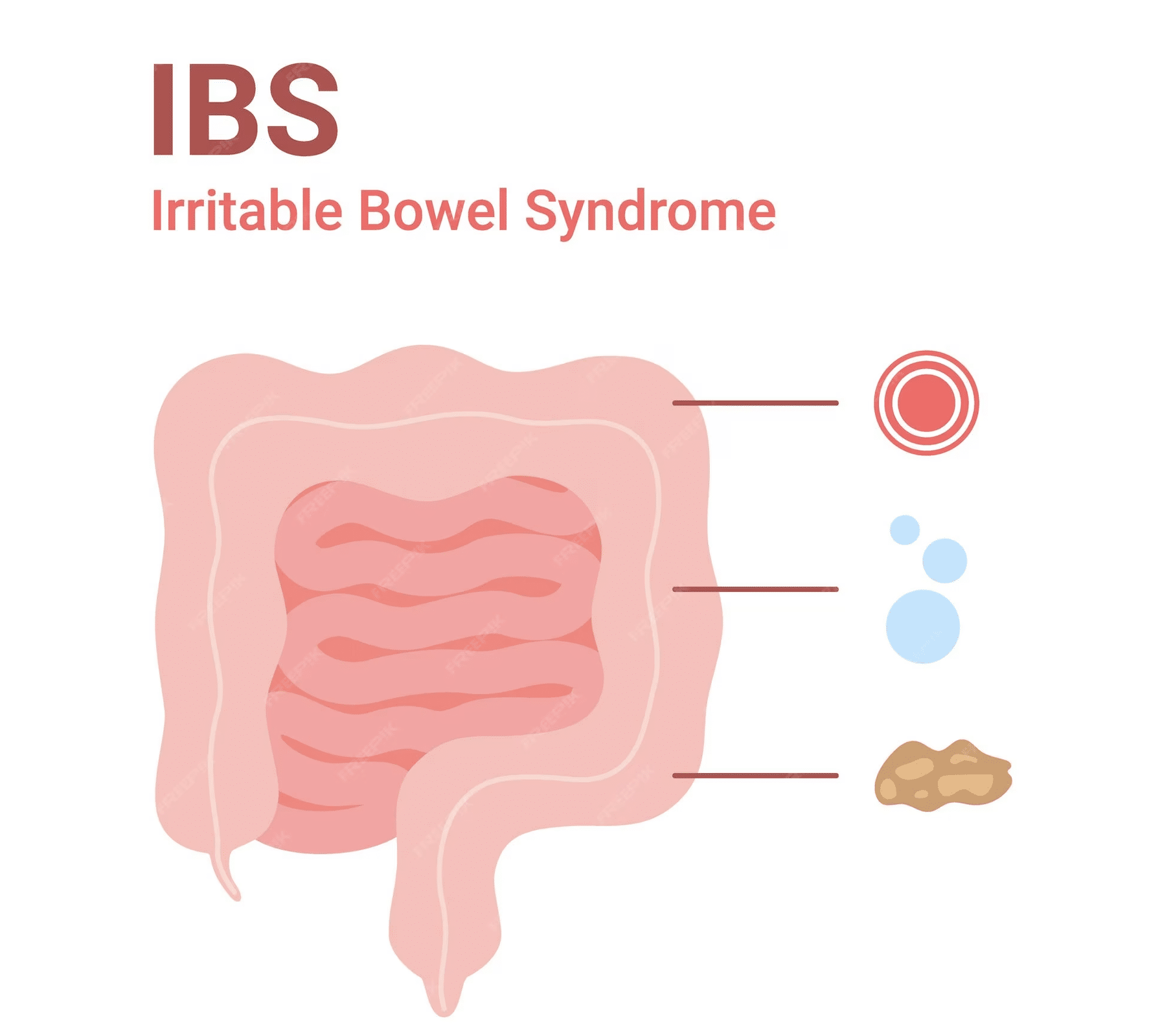 IBS
