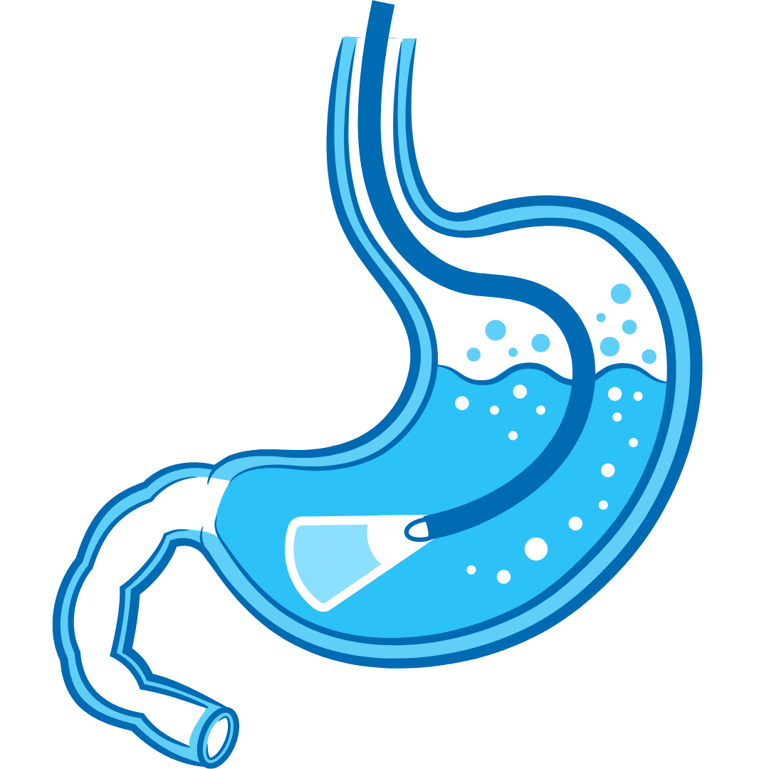 gastroesophegal gastroesophegal